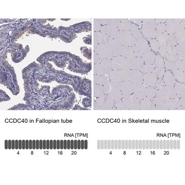 Anti-CCDC40 antibody produced in rabbit Prestige Antibodies&#174; Powered by Atlas Antibodies, affinity isolated antibody, buffered aqueous glycerol solution