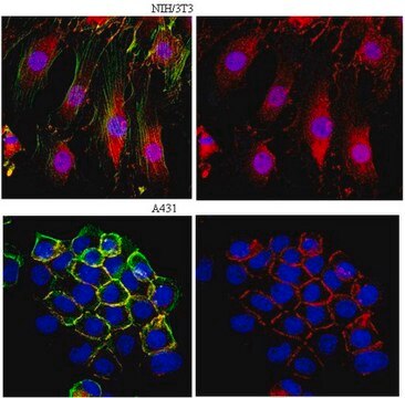 Anti-&#946;-Catenin Antibody from rabbit, purified by affinity chromatography