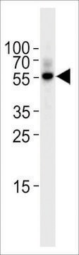 ANTI-TGF BETA 2(C-TERMINAL) antibody produced in rabbit IgG fraction of antiserum, buffered aqueous solution