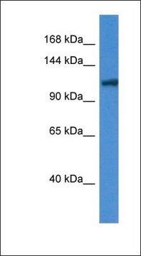 Anti-ANO6 antibody produced in rabbit affinity isolated antibody