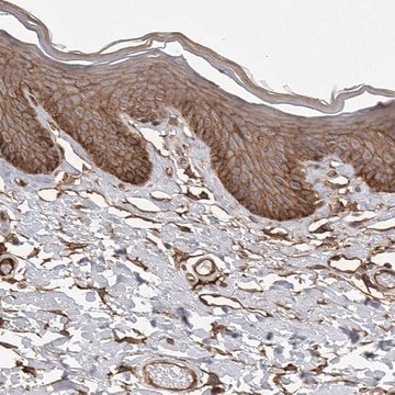 Anti-NECTIN1 antibody produced in rabbit Prestige Antibodies&#174; Powered by Atlas Antibodies, affinity isolated antibody, buffered aqueous glycerol solution