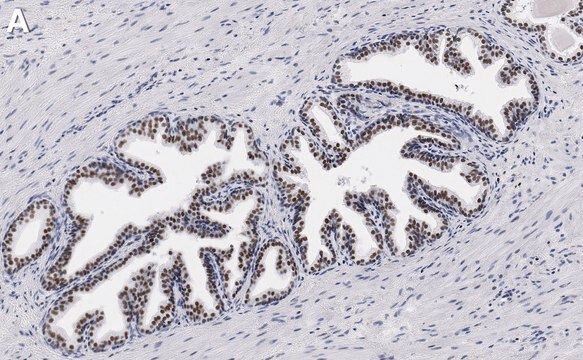 Anti-FOXP1 Antibody, clone 1J11-H1 ZooMAb&#174; Rabbit Monoclonal recombinant, expressed in HEK 293 cells