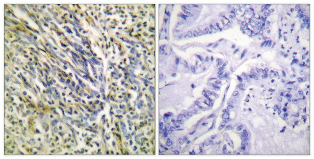 Anti-Aggrecan (Cleaved-Asp369), N-Terminal antibody produced in rabbit affinity isolated antibody