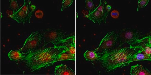 Anti-TLS Antibody, clone 1FU-1D2 ascites fluid, clone 1FU-1D2, from mouse