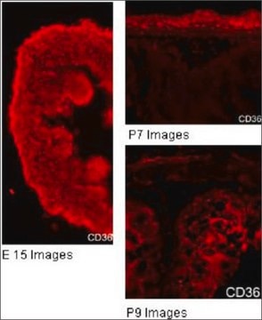 Anti-CD36 affinity isolated antibody