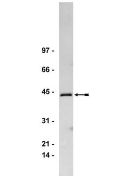 Anti-Gq/11&#945; Antibody, CT Upstate&#174;, from rabbit