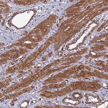 Anti-TNS1 antibody produced in rabbit Prestige Antibodies&#174; Powered by Atlas Antibodies, affinity isolated antibody, buffered aqueous glycerol solution