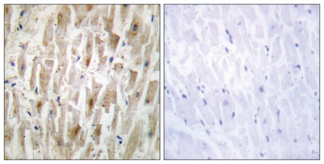 Anti-LIMK2 antibody produced in rabbit affinity isolated antibody