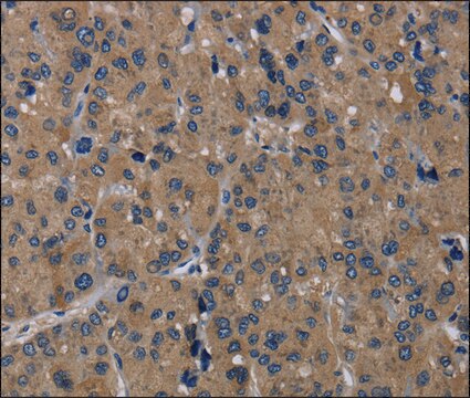 Anti-TRPM1 antibody produced in rabbit affinity isolated antibody