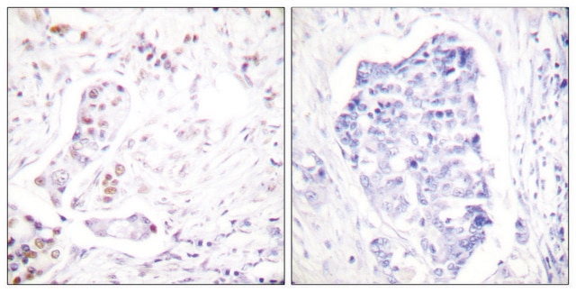 Anti-Cyclin A1 antibody produced in rabbit affinity isolated antibody