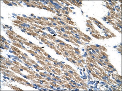 Anti-KEAP1 (AB2) antibody produced in rabbit affinity isolated antibody