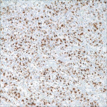 Renal Cell Carcinoma (PN-15) Mouse Monoclonal Antibody