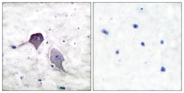 Anti-Presenilin 1 antibody produced in rabbit affinity isolated antibody