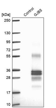 Anti-GJB5 antibody produced in rabbit Prestige Antibodies&#174; Powered by Atlas Antibodies, affinity isolated antibody, buffered aqueous glycerol solution