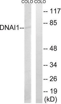 Anti-DNAI1 antibody produced in rabbit affinity isolated antibody