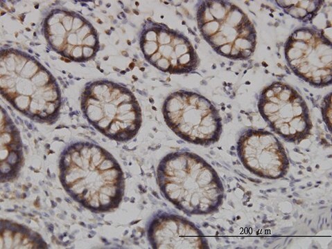 Monoclonal Anti-TYK2 antibody produced in mouse clone 6G12, purified immunoglobulin, buffered aqueous solution