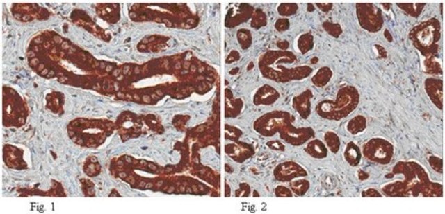 Anti-Lysyl Oxidase (LOX) Antibody from rabbit, purified by affinity chromatography