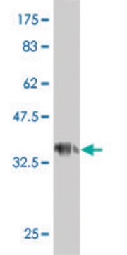 ANTI-GUCY2C antibody produced in mouse clone 1G5, purified immunoglobulin, buffered aqueous solution