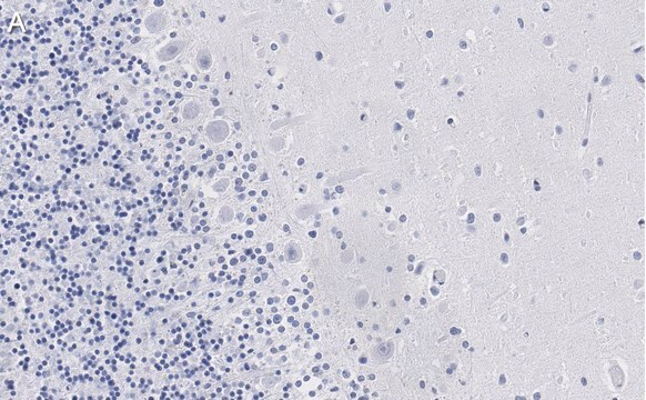 Anti-Aldolase C Antibody, clone 3B18, ZooMAb&#174; Rabbit Monoclonal recombinant, expressed in HEK 293 cells