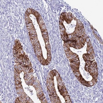 Anti-ABHD17B antibody produced in rabbit Prestige Antibodies&#174; Powered by Atlas Antibodies, affinity isolated antibody, buffered aqueous glycerol solution