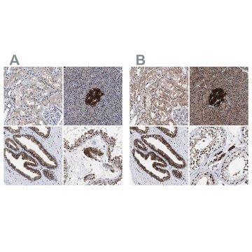 Anti-ACLY antibody produced in rabbit Prestige Antibodies&#174; Powered by Atlas Antibodies, affinity isolated antibody, buffered aqueous glycerol solution