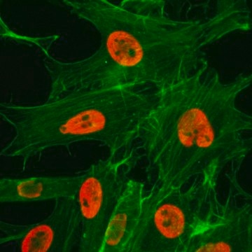 Anti-Acetyl-Histone H3 (Lys27) antibody, Rabbit monoclonal recombinant, expressed in HEK 293 cells, clone RM172, purified immunoglobulin