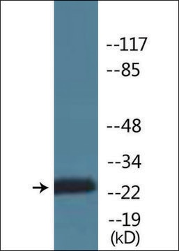 Anti-phospho-CKII-&#946; (pSer209) antibody produced in rabbit affinity isolated antibody