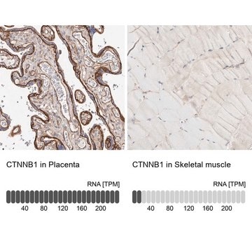 Anti-CTNNB1 antibody produced in rabbit Prestige Antibodies&#174; Powered by Atlas Antibodies, affinity isolated antibody, buffered aqueous glycerol solution, ab2