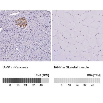 Anti-IAPP antibody produced in rabbit Prestige Antibodies&#174; Powered by Atlas Antibodies, affinity isolated antibody, buffered aqueous glycerol solution