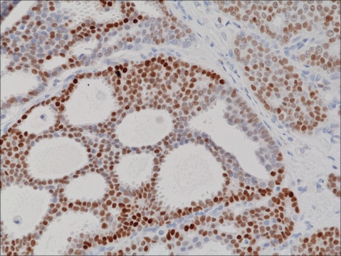 Anti-PR (Progesterone Receptor) antibody, Rabbit monoclonal recombinant, expressed in HEK 293 cells, clone RM357, purified immunoglobulin