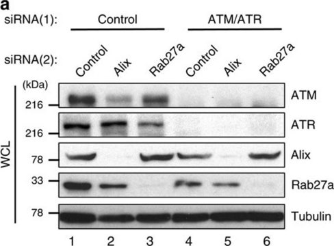 Anti-ATM antibody,Mouse monoclonal clone MAT3-4G10/8, purified from hybridoma cell culture