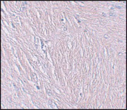 Anti-SYNPO antibody produced in rabbit affinity isolated antibody, buffered aqueous solution