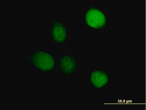 Anti-TSEN2 antibody produced in mouse IgG fraction of antiserum, buffered aqueous solution