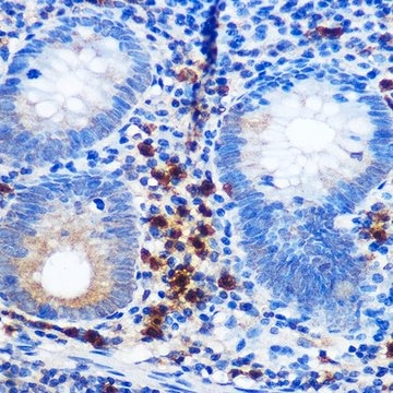 Anti-CD41/ITGA2B antibody produced in rabbit