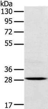 Anti-TREM2 affinity isolated antibody