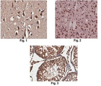 Anti-Serotonin receptor 2A/HTR2A Antibody, clone 9B11.1 clone 9B11.1, from mouse