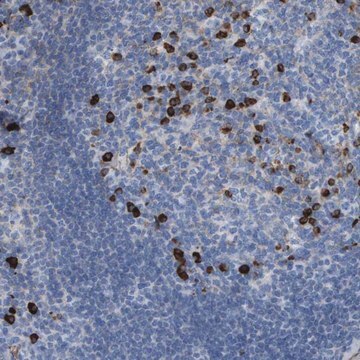 Anti-IFNAR1 antibody produced in rabbit Prestige Antibodies&#174; Powered by Atlas Antibodies, affinity isolated antibody, buffered aqueous glycerol solution