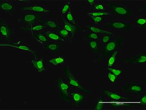 Anti-ALOX5 antibody produced in rabbit purified immunoglobulin, buffered aqueous solution