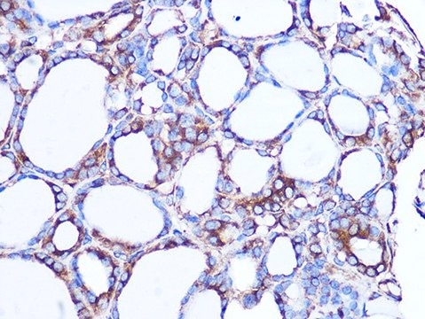 Anti-LOXL2 antibody produced in rabbit