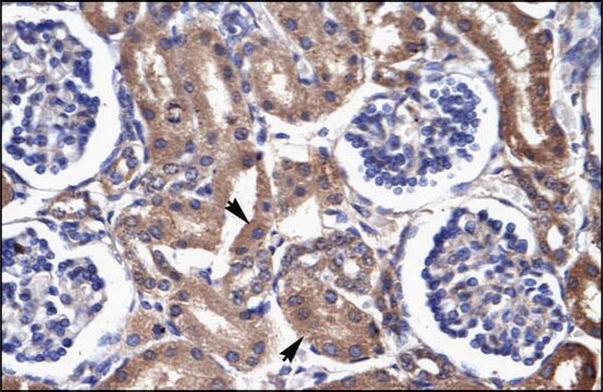 Anti-FABP3 antibody produced in rabbit IgG fraction of antiserum