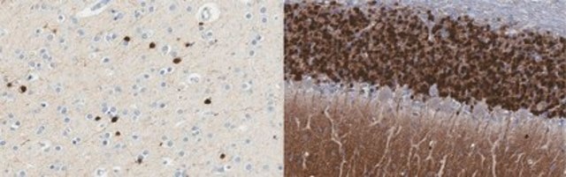 Anti-Calretinin from rabbit, purified by affinity chromatography