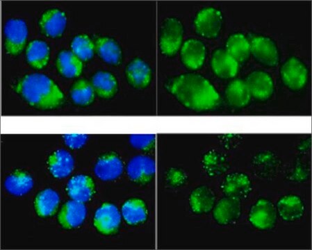 Anti-CAT antibody produced in rabbit affinity isolated antibody