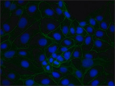 Monoclonal Anti-Plakoglobin (Catenin &#947;) antibody produced in mouse clone 15F11, ascites fluid, buffered aqueous solution