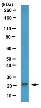 Anti-RBP4 Antibody from rabbit, purified by affinity chromatography