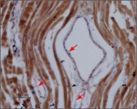 Anti-Sodium Channel NaV1.5 human antibody produced in rabbit affinity isolated antibody, lyophilized powder