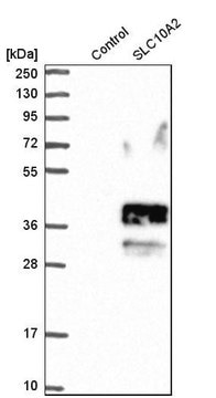 Anti-SLC10A2 antibody produced in rabbit Prestige Antibodies&#174; Powered by Atlas Antibodies, affinity isolated antibody, buffered aqueous glycerol solution