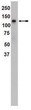 Anti-SREBP1 Antibody, clone 2121 clone 2121, Upstate&#174;, from mouse