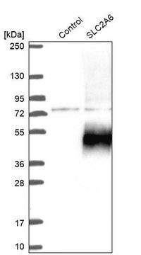 Anti-SLC2A6 antibody produced in rabbit Prestige Antibodies&#174; Powered by Atlas Antibodies, affinity isolated antibody, buffered aqueous glycerol solution