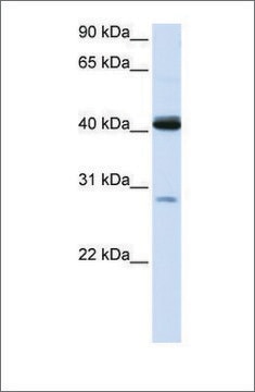 Anti-GCDH antibody produced in rabbit affinity isolated antibody