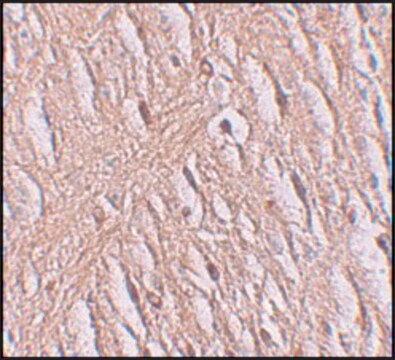 Anti-ZIP9 antibody produced in rabbit affinity isolated antibody, buffered aqueous solution